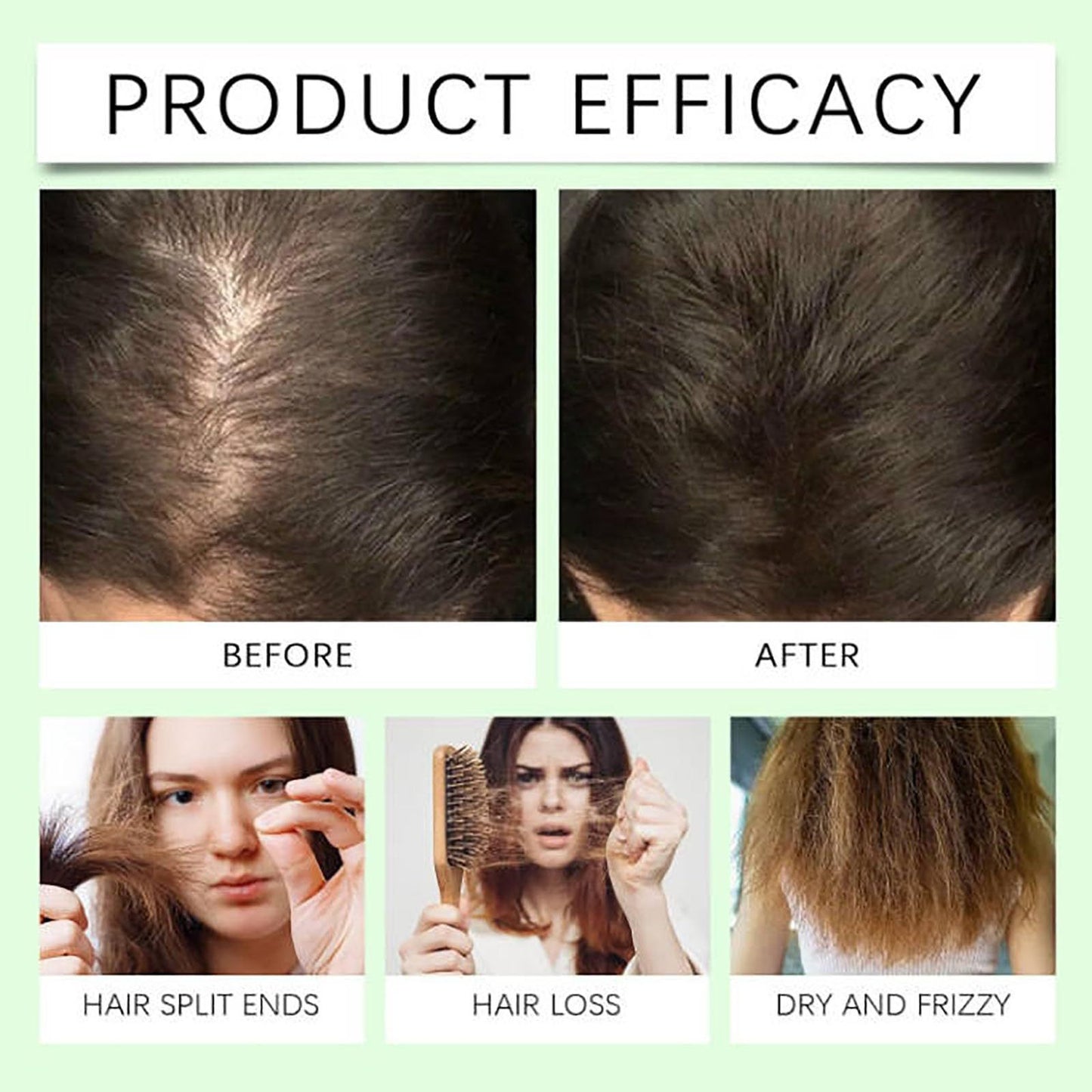 【Buy 1 Get 1 Free】Anti-Hair Fall Hair Loss Treatment Shampoo Oil Control Anti dandruff Haircare Ginseng Ginger Help Hair Growth Jojoba Oat Repair Reduce Hair Loss Scalp Cleanser Conditioner-HHH