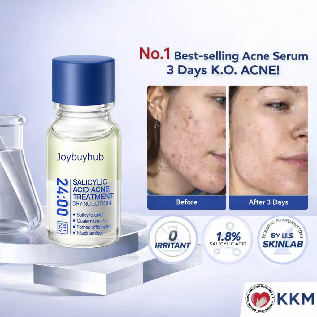 🔥[6𝟎% 𝐎𝐅𝐅 𝐋𝐀𝐒𝐓 𝐓𝐇𝐑𝐄𝐄 𝐃𝐀𝐘𝐒] 24H Acne & Pimple Treatment Drying Lotion | Salicylic Acid + Sulfur + Niacinamide | Viral Product | Inflammation Relief, Post-Blemish Care & High Pressure Pimple Relief-AAA1
