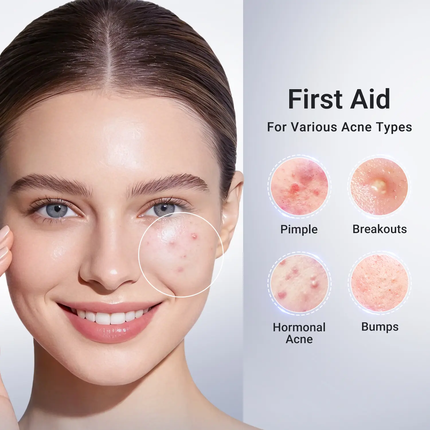 🔥[5𝟎% 𝐎𝐅𝐅 𝐋𝐀𝐒𝐓 𝐓𝐇𝐑𝐄𝐄 𝐃𝐀𝐘𝐒]Dr.Leo Drying Lotion Plus | Acne & PimpleTreatment I Visibly Shrinks Pimples in 24 Hours& Helps Fade Acne Marks in 7 Days I With 1.8%Encapsulated Salicylic Acid, 4% Niacinamide &10% Sulfur (20ml)-JKL