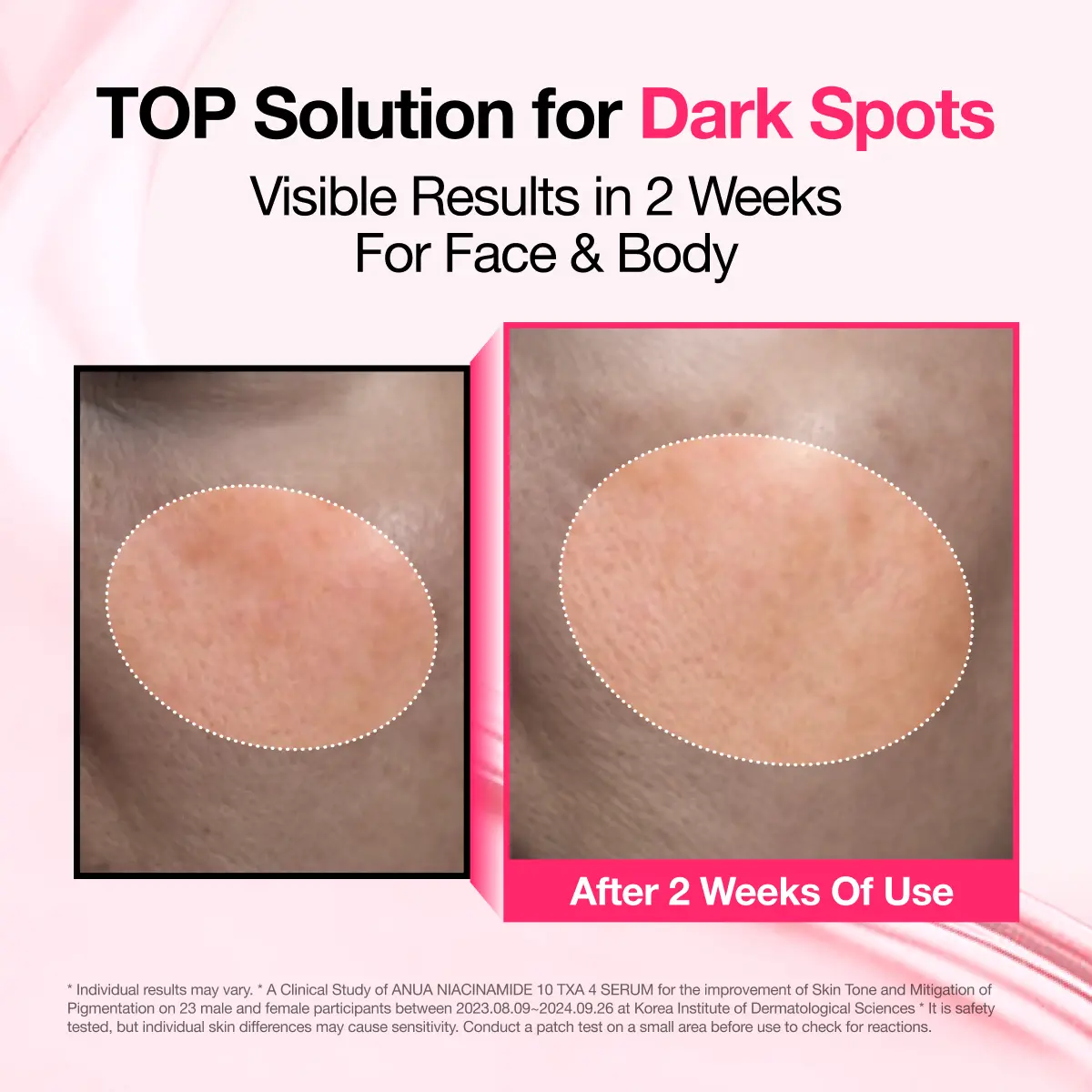 🔥[5𝟎% 𝐎𝐅𝐅 𝐋𝐀𝐒𝐓 𝐓𝐇𝐑𝐄𝐄 𝐃𝐀𝐘𝐒][Anua] Dark Spot Correcting Serum : 10%Niacinamide+ 4% Tranexamic Acid 1.01 fl.oz.(30ml) | Niacinamide Serum, PM Skincareproduct, Hyperpigmentation, Brightening-JKL