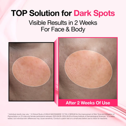 🔥[5𝟎% 𝐎𝐅𝐅 𝐋𝐀𝐒𝐓 𝐓𝐇𝐑𝐄𝐄 𝐃𝐀𝐘𝐒][Anua] Dark Spot Correcting Serum : 10%Niacinamide+ 4% Tranexamic Acid 1.01 fl.oz.(30ml) | Niacinamide Serum, PM Skincareproduct, Hyperpigmentation, Brightening-JKL