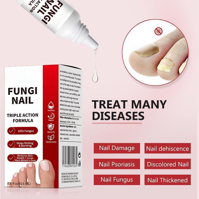 🔥[55% 𝐎𝐅𝐅 𝐋𝐀𝐒𝐓 𝐓𝐇𝐑𝐄𝐄 𝐃𝐀𝐘𝐒]Nail Triple Action Formula - 0.5 fl oz Liquid Treatment for Nail Fungus, Antifungal Solution, Repair & Restore Damaged Nails, Enhanced Formula-LU