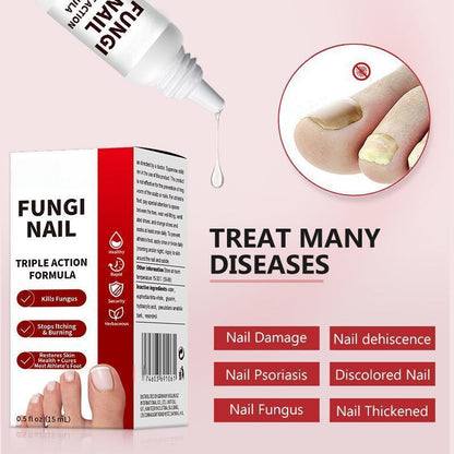 🔥[55% 𝐎𝐅𝐅 𝐋𝐀𝐒𝐓 𝐓𝐇𝐑𝐄𝐄 𝐃𝐀𝐘𝐒]Nail Triple Action Formula - 0.5 fl oz Liquid Treatment for Nail Fungus, Antifungal Solution, Repair & Restore Damaged Nails, Enhanced Formula-LU