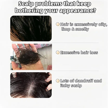 【Buy 1 Get 1 Free】Anti-Hair Fall Hair Loss Treatment Shampoo Oil Control Anti dandruff Haircare Ginseng Ginger Help Hair Growth Jojoba Oat Repair Reduce Hair Loss Scalp Cleanser Conditioner-HHH