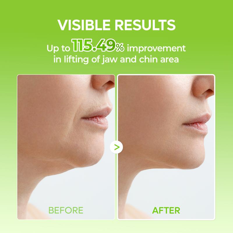 CACTOX V-LIFTING MEWING BAND with Cactus Cooling Reduce Puffiness & Pore Tightening for Visible Pore Care Skin Repair-OA