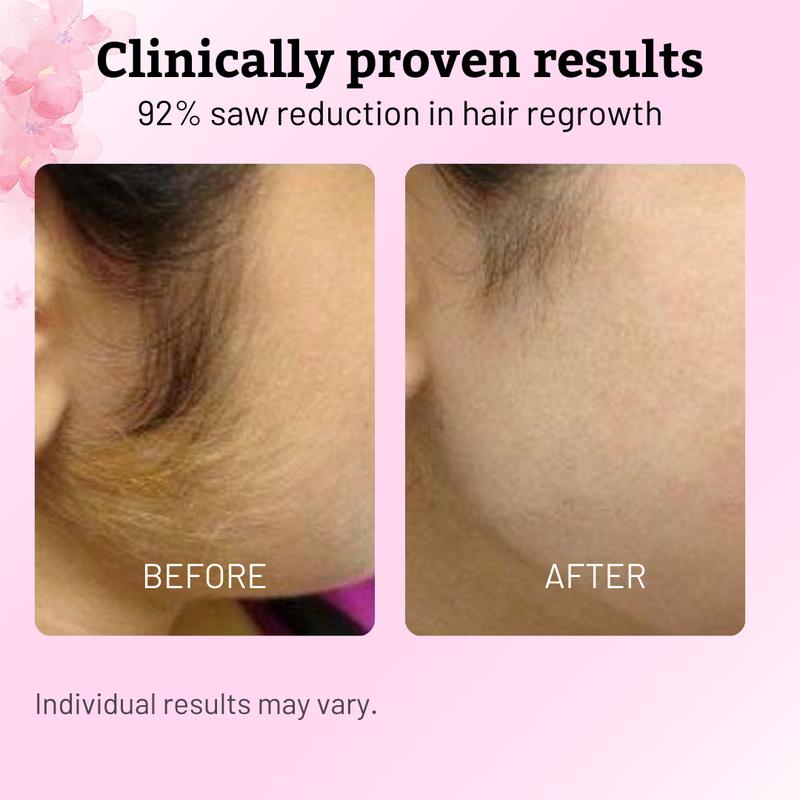 🔥[5𝟎% 𝐎𝐅𝐅 𝐋𝐀𝐒𝐓 𝐓𝐇𝐑𝐄𝐄 𝐃𝐀𝐘𝐒]Caramela Beauty Cyperus Rotundus Oil for Natural Hair Reduction - 60ml/2oz-JKL