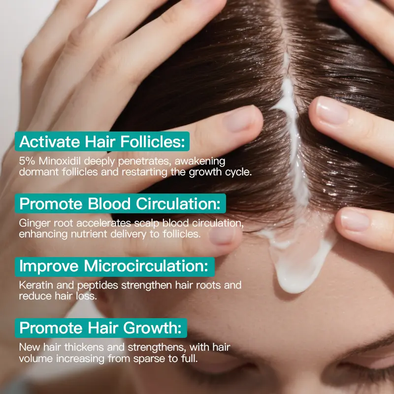 🔥[5𝟎% 𝐎𝐅𝐅 𝐋𝐀𝐒𝐓 𝐓𝐇𝐑𝐄𝐄 𝐃𝐀𝐘𝐒][BUY 1 GET 1 FREEJKORMESIC 5% MinoxidilHair Growth Scalp Massage Cream with Keratin& Ginger for Men Women Prevents LossRepairs Follicles Promotes Fast RegrowthStrengthens Roots Buy 1 Get 1 Free-JKL