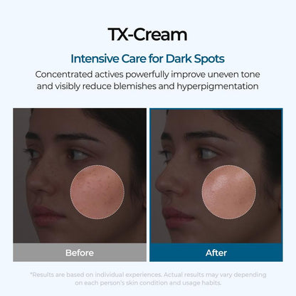 🔥[5𝟎% 𝐎𝐅𝐅 𝐋𝐀𝐒𝐓 𝐓𝐇𝐑𝐄𝐄 𝐃𝐀𝐘𝐒][Dr.Melaxin Official] TX Cream 50ml｜Nano-sized Tranexaminc Acid for Dark Spots & Hyperpigmentation-JKL