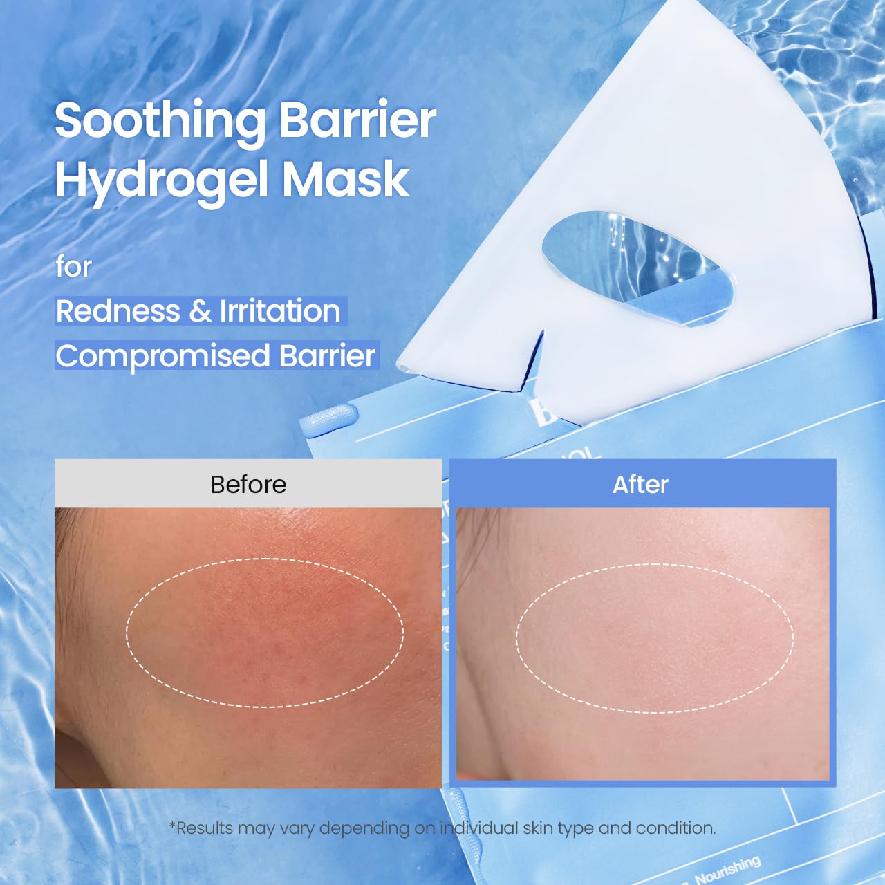 🔥[5𝟎% 𝐎𝐅𝐅 𝐋𝐀𝐒𝐓 𝐓𝐇𝐑𝐄𝐄 𝐃𝐀𝐘𝐒]BIODANCE Hydro Cera-nol Real Deep Mask, Hydrating Overnight Hydrogel Face Mask, Moisturizing, Redness Reducing, Quick Soothing, After Sun Care, Sunburn Relief, Korean Skin Care |1.19oz(34g) x4ea-JKL