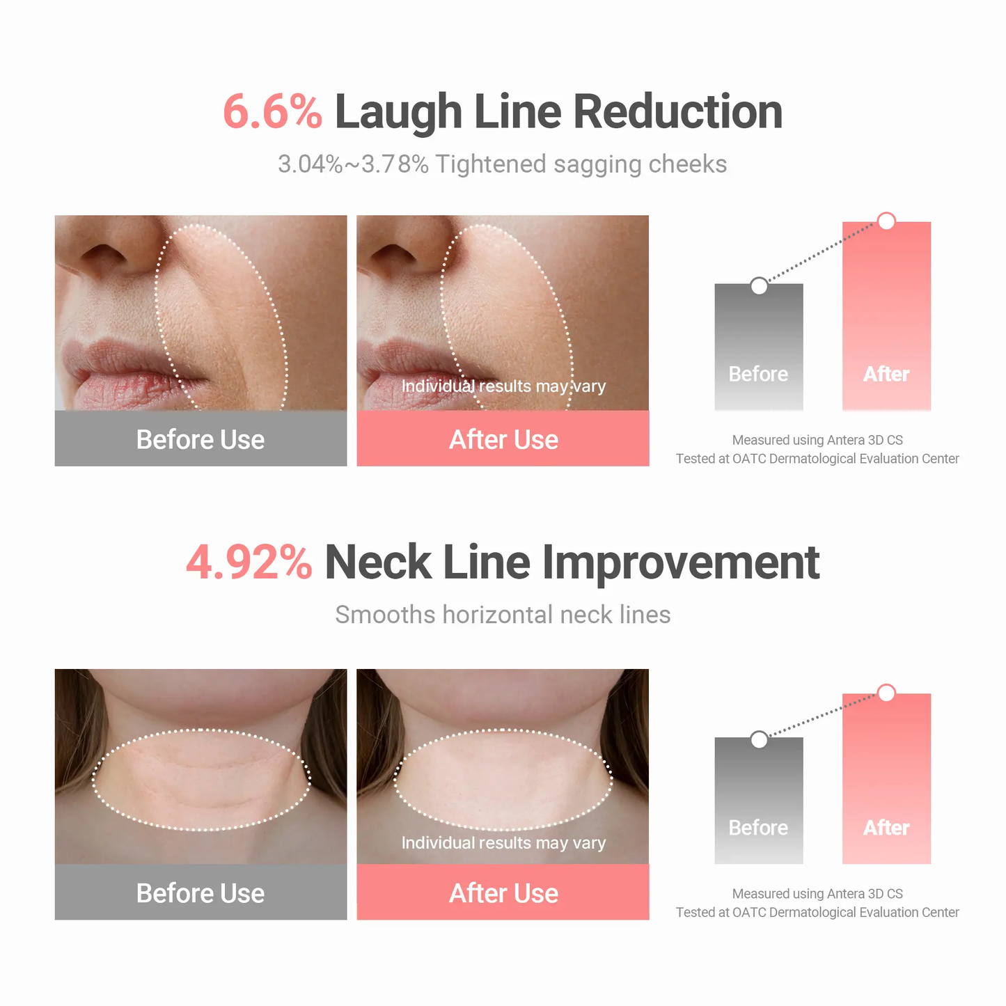 🔥[5𝟎% 𝐎𝐅𝐅 𝐋𝐀𝐒𝐓 𝐓𝐇𝐑𝐄𝐄 𝐃𝐀𝐘𝐒]KAHI Wrinkle Bounce Multi Balm Stick - PDRNCollagen Wrinkle Stick & Hydrating Multi-UseBalm for Face Lips & Neck Anti-Aging RadianceBooster with Salmon Collagen Jeju FermentedOil & PDRN Skin Repair Moisturizing-JKL