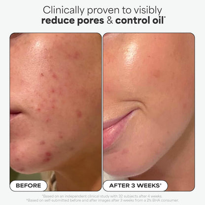 🔥[5𝟎% 𝐎𝐅𝐅 𝐋𝐀𝐒𝐓 𝐓𝐇𝐑𝐄𝐄 𝐃𝐀𝐘𝐒]Paula's Choice SKIN PERFECTING 2% BHA Liquid Exfoliant with Salicylic Acid, Facial Polish for Enlarged Pores, Wrinkles & Fine Lines, Suitable for Blackhead-Prone Skin, Fragrance-Free-JKL