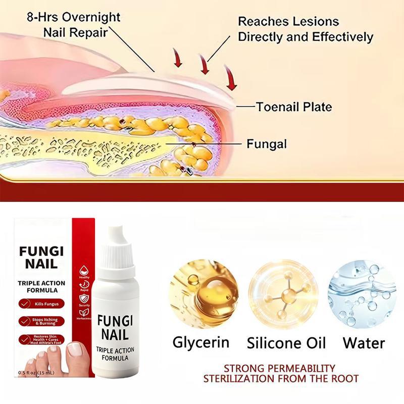 🔥[55% 𝐎𝐅𝐅 𝐋𝐀𝐒𝐓 𝐓𝐇𝐑𝐄𝐄 𝐃𝐀𝐘𝐒]Nail Triple Action Formula - 0.5 fl oz Liquid Treatment for Nail Fungus, Antifungal Solution, Repair & Restore Damaged Nails, Enhanced Formula-LU