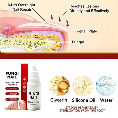 🔥[55% 𝐎𝐅𝐅 𝐋𝐀𝐒𝐓 𝐓𝐇𝐑𝐄𝐄 𝐃𝐀𝐘𝐒]Nail Triple Action Formula - 0.5 fl oz Liquid Treatment for Nail Fungus, Antifungal Solution, Repair & Restore Damaged Nails, Enhanced Formula-LU