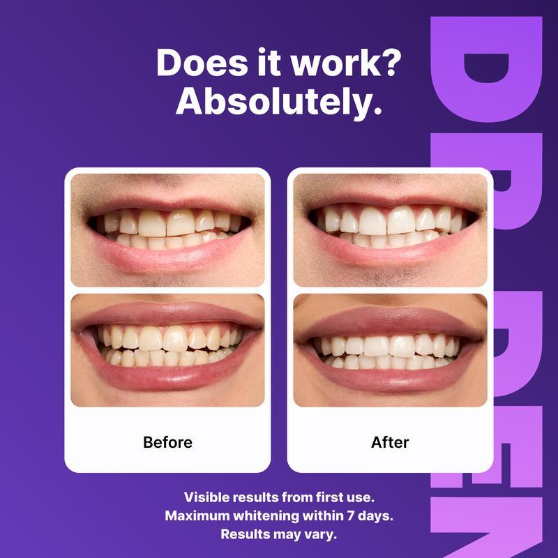 Purple Teeth Whitening Strips - 7/21 Whitening Sessions - Safe for Enamel - Non Sensitive Teeth Whitening - Peroxide-Free-VIP