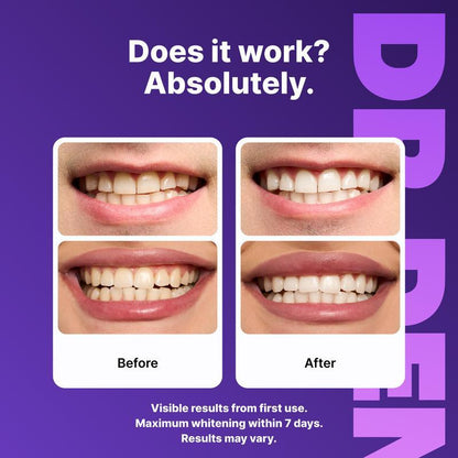 Purple Teeth Whitening Strips - 7/21 Whitening Sessions - Safe for Enamel - Non Sensitive Teeth Whitening - Peroxide-Free-VIP