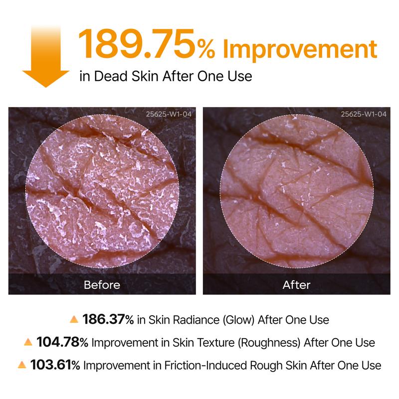 🔥[5𝟎% 𝐎𝐅𝐅 𝐋𝐀𝐒𝐓 𝐓𝐇𝐑𝐄𝐄 𝐃𝐀𝐘𝐒][Dr.melaxin Official] Peel Shot Keratin Care Kojic Acid Turmeric Spray 200ml Pore Clearing Exfoliating Formula Skin Repair Scrub-JKL
