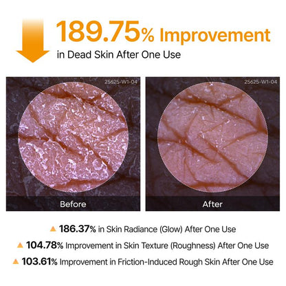 🔥[5𝟎% 𝐎𝐅𝐅 𝐋𝐀𝐒𝐓 𝐓𝐇𝐑𝐄𝐄 𝐃𝐀𝐘𝐒][Dr.melaxin Official] Peel Shot Keratin Care Kojic Acid Turmeric Spray 200ml Pore Clearing Exfoliating Formula Skin Repair Scrub-JKL