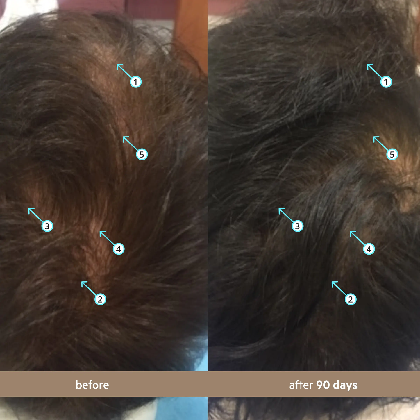 🔥[5𝟎% 𝐎𝐅𝐅 𝐋𝐀𝐒𝐓 𝐓𝐇𝐑𝐄𝐄 𝐃𝐀𝐘𝐒]Spectral Men's (Spectral.DNC-N) | Hair Density Serum with Nanoxidil 5%-JKL