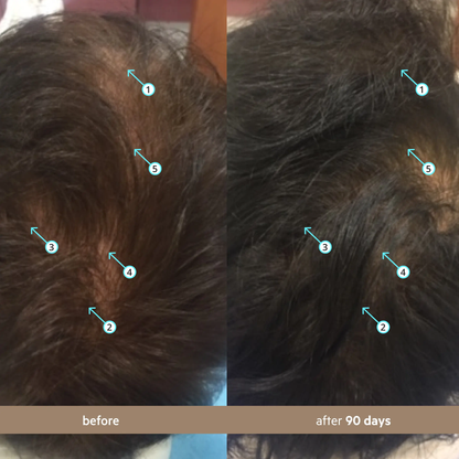 🔥[5𝟎% 𝐎𝐅𝐅 𝐋𝐀𝐒𝐓 𝐓𝐇𝐑𝐄𝐄 𝐃𝐀𝐘𝐒]Spectral Men's (Spectral.DNC-N) | Hair Density Serum with Nanoxidil 5%-JKL