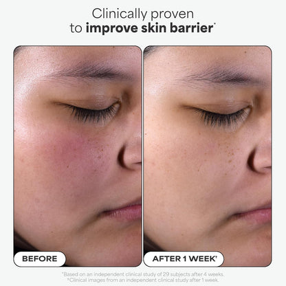 🔥[5𝟎% 𝐎𝐅𝐅 𝐋𝐀𝐒𝐓 𝐓𝐇𝐑𝐄𝐄 𝐃𝐀𝐘𝐒]Paula's Choice SKIN PERFECTING 2% BHA Liquid Exfoliant with Salicylic Acid, Facial Polish for Enlarged Pores, Wrinkles & Fine Lines, Suitable for Blackhead-Prone Skin, Fragrance-Free-JKL