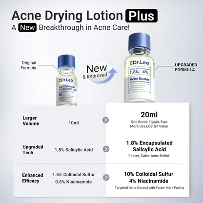 🔥[5𝟎% 𝐎𝐅𝐅 𝐋𝐀𝐒𝐓 𝐓𝐇𝐑𝐄𝐄 𝐃𝐀𝐘𝐒]Dr.Leo Drying Lotion Plus | Acne & PimpleTreatment I Visibly Shrinks Pimples in 24 Hours& Helps Fade Acne Marks in 7 Days I With 1.8%Encapsulated Salicylic Acid, 4% Niacinamide &10% Sulfur (20ml)-JKL