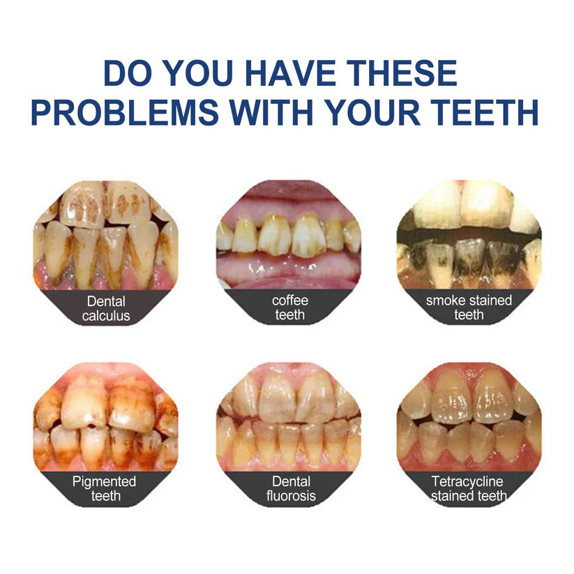 🔥Ends Tonight: Get 60% OFF Before It’s Gone!🎁 Joybuyhub™ Fluoride-Free Hydroxyapatite Toothpaste – Gentle Whitening & Enamel Strength for Sensitive Teeth-OA