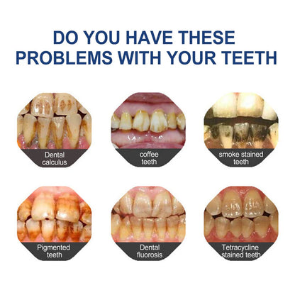 🔥Ends Tonight: Get 60% OFF Before It’s Gone!🎁 Joybuyhub™ Fluoride-Free Hydroxyapatite Toothpaste – Gentle Whitening & Enamel Strength for Sensitive Teeth-OA