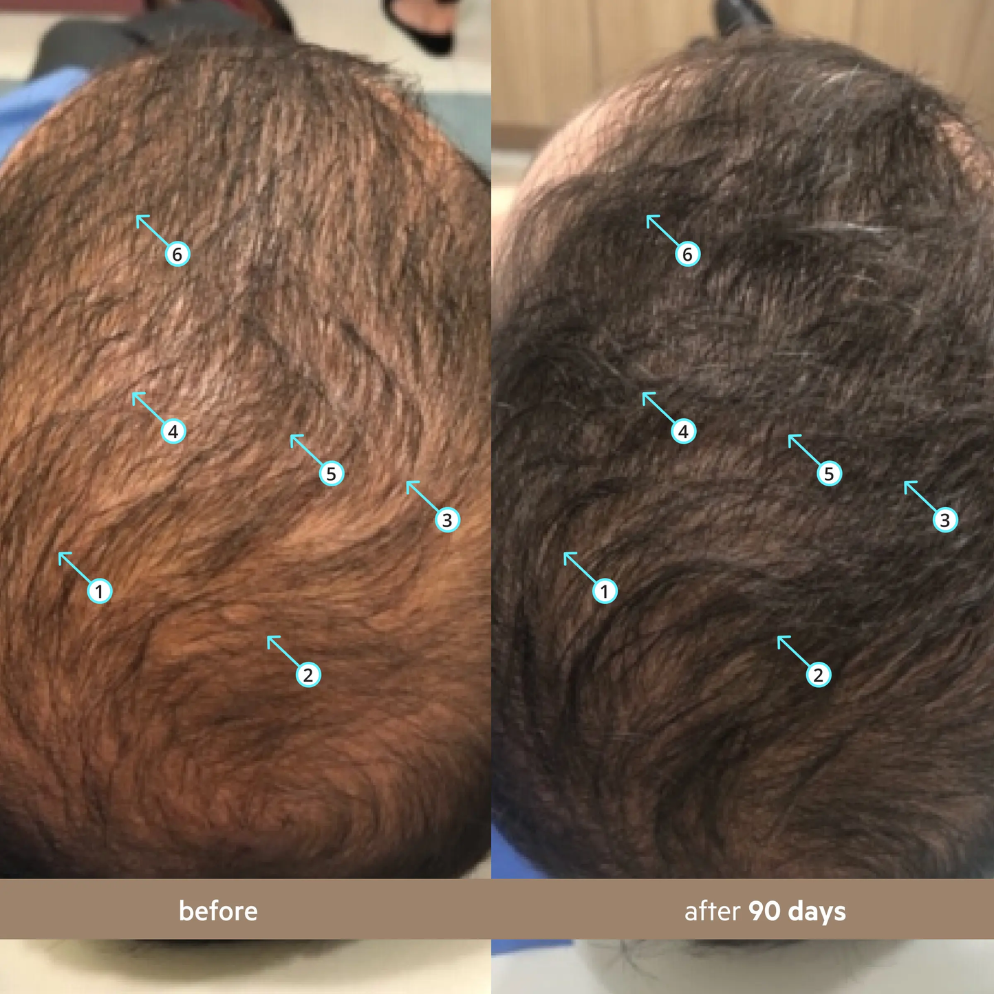 🔥[5𝟎% 𝐎𝐅𝐅 𝐋𝐀𝐒𝐓 𝐓𝐇𝐑𝐄𝐄 𝐃𝐀𝐘𝐒]Spectral Men's (Spectral.DNC-N) | Hair Density Serum with Nanoxidil 5%-JKL