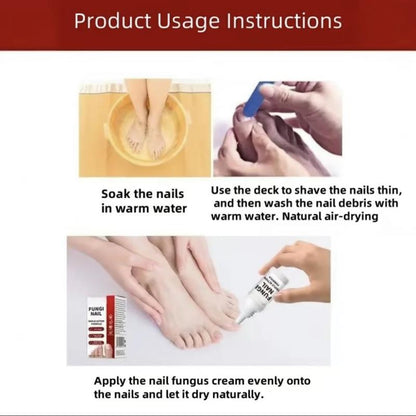 🔥[55% 𝐎𝐅𝐅 𝐋𝐀𝐒𝐓 𝐓𝐇𝐑𝐄𝐄 𝐃𝐀𝐘𝐒]Nail Triple Action Formula - 0.5 fl oz Liquid Treatment for Nail Fungus, Antifungal Solution, Repair & Restore Damaged Nails, Enhanced Formula-LU