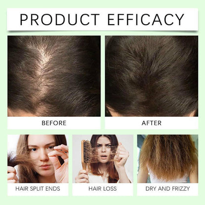 【Buy 1 Get 1 Free】Anti-Hair Fall Hair Loss Treatment Shampoo Oil Control Anti dandruff Haircare Ginseng Ginger Help Hair Growth Jojoba Oat Repair Reduce Hair Loss Scalp Cleanser Conditioner-HHH