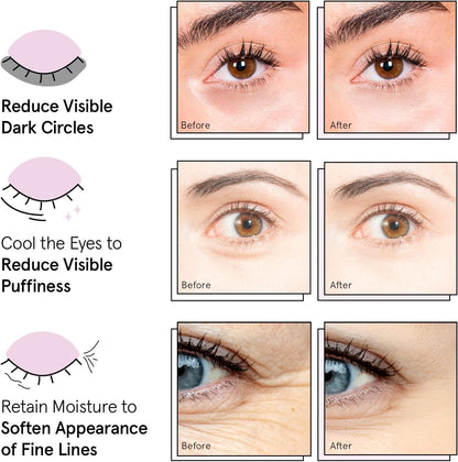 🔥[5𝟎% 𝐎𝐅𝐅 𝐋𝐀𝐒𝐓 𝐓𝐇𝐑𝐄𝐄 𝐃𝐀𝐘𝐒]Award Winning Under Eye Mask - Birthday Gifts for Women - Gel Eye Patches for Dark Circles, Puffy Eyes, Undereye Bags - Gifts for Mom - Travel Essentials - Vegan (24 Pairs, Gold)-JKL