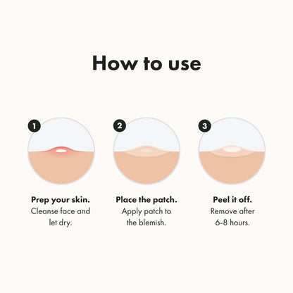 🔥[5𝟎% 𝐎𝐅𝐅 𝐋𝐀𝐒𝐓 𝐓𝐇𝐑𝐄𝐄 𝐃𝐀𝐘𝐒]Mighty Patch Original Patch from Hero Cosmetics - #1 Hydrocolloid Acne Pimple Patches for Face, Shrinking Zits & Whiteheads in 1 Use, Nighttime Spot Pimple Stickers for Face, 36 Count-JKL