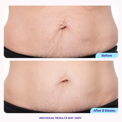 JOYBUYHUB Tighten & Smooth Belly Firming Cream-OA