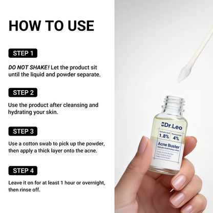 🔥[5𝟎% 𝐎𝐅𝐅 𝐋𝐀𝐒𝐓 𝐓𝐇𝐑𝐄𝐄 𝐃𝐀𝐘𝐒]Dr.Leo Drying Lotion Plus | Acne & PimpleTreatment I Visibly Shrinks Pimples in 24 Hours& Helps Fade Acne Marks in 7 Days I With 1.8%Encapsulated Salicylic Acid, 4% Niacinamide &10% Sulfur (20ml)-JKL