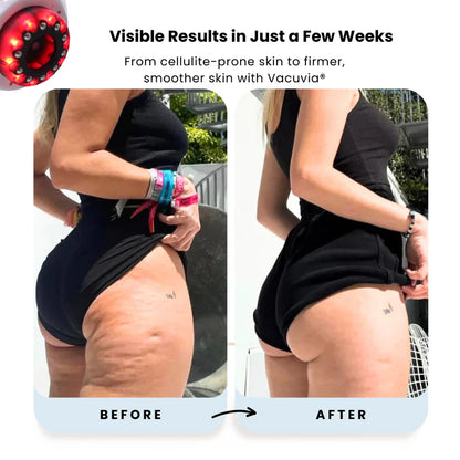 🔥[60% 𝐎𝐅𝐅 𝐋𝐀𝐒𝐓 𝐓𝐇𝐑𝐄𝐄 𝐃𝐀𝐘𝐒]Handheld Body Massager for Legs & Belly - Lymphatic Drainage & Anti swelling Tool with Heat, Vibration-LU