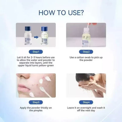 🔥[75% 𝐎𝐅𝐅 𝐋𝐀𝐒𝐓 𝐓𝐇𝐑𝐄𝐄 𝐃𝐀𝐘𝐒]24H Acne & Pimple Treatment Drying Lotion | Salicylic Acid + Sulfur + Niacinamide | Viral Product | Inflammation Relief, Post-Blemish Care & High Pressure Pimple Relief-3@OK