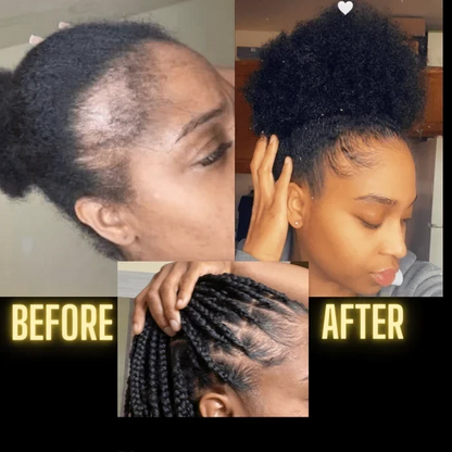 [🔥Fresh Deals Are Here🔥] Scalp Stimulator Hair Growth Oil - Lightweight Rosemary & Mint Blend for Thicker, Fuller Hair, Alopecia Support & Hair Regrowth-LU