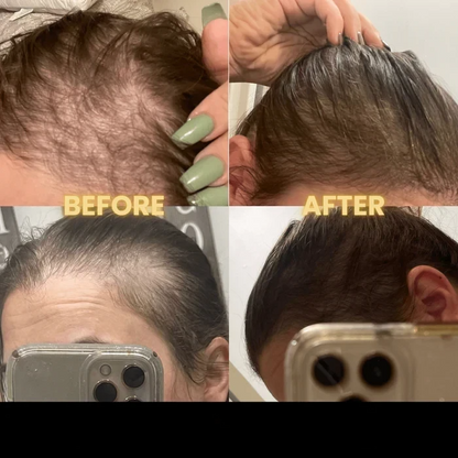 [🔥Fresh Deals Are Here🔥] Scalp Stimulator Hair Growth Oil - Lightweight Rosemary & Mint Blend for Thicker, Fuller Hair, Alopecia Support & Hair Regrowth-LU