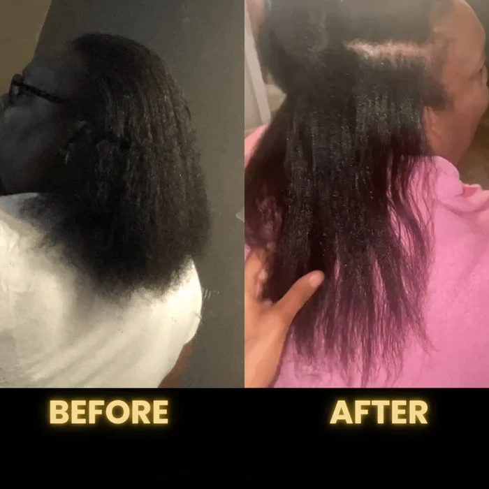 [🔥Fresh Deals Are Here🔥] Scalp Stimulator Hair Growth Oil - Lightweight Rosemary & Mint Blend for Thicker, Fuller Hair, Alopecia Support & Hair Regrowth-LU